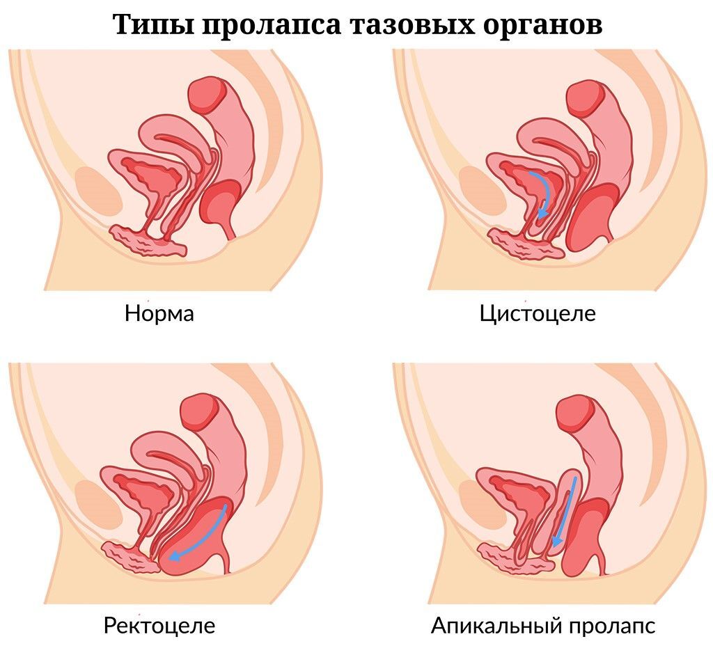 Палочка «Доянь», ЧКА для сокращения влагалища, 1 шт