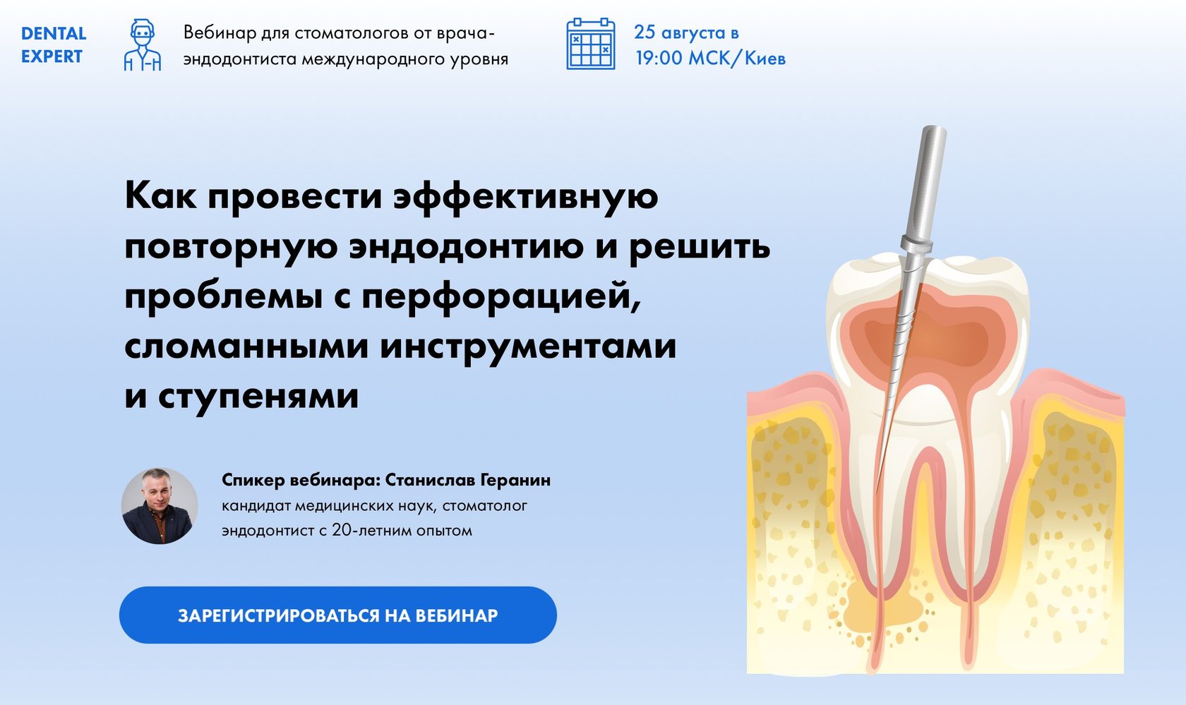 Регенеративная эндодонтия презентация