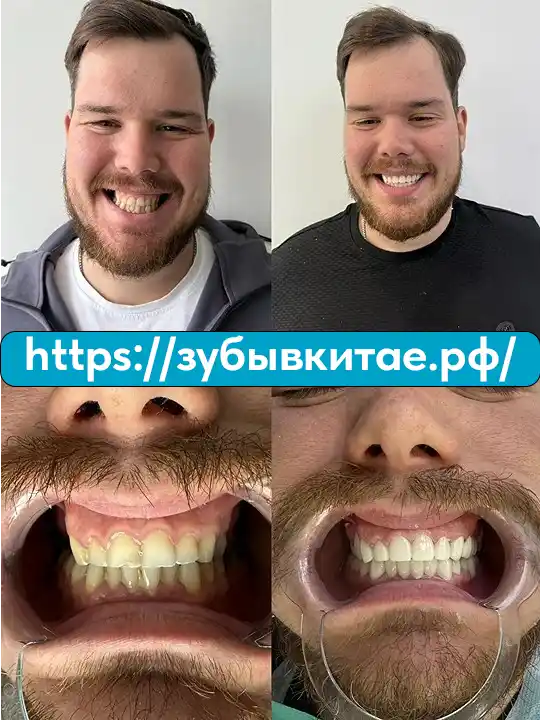 До и после — кейс 11