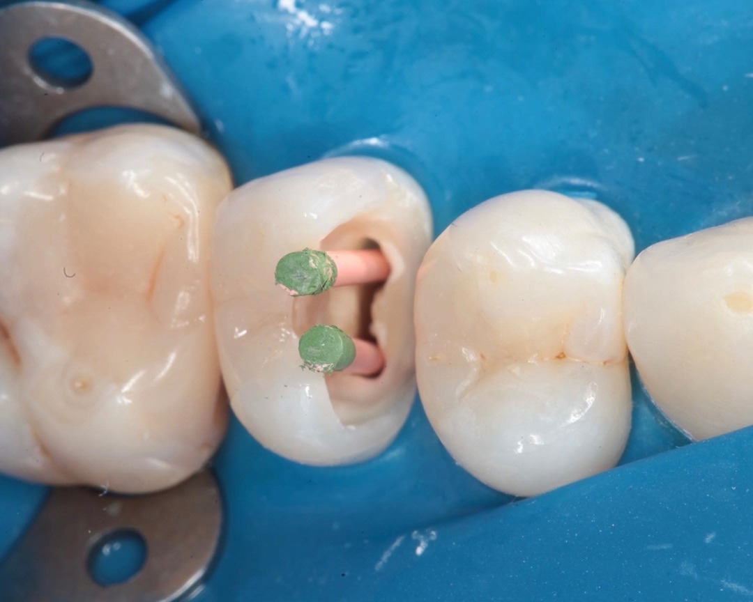 Терапия — Dental Studio