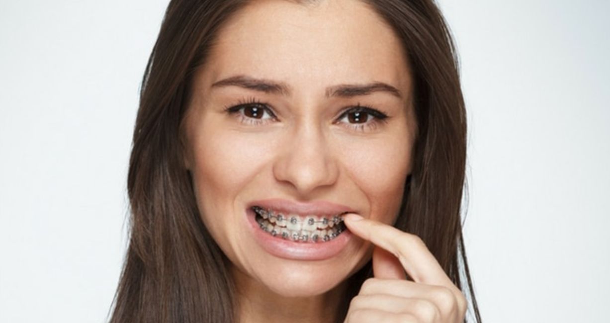 Больно ли носить брекеты?