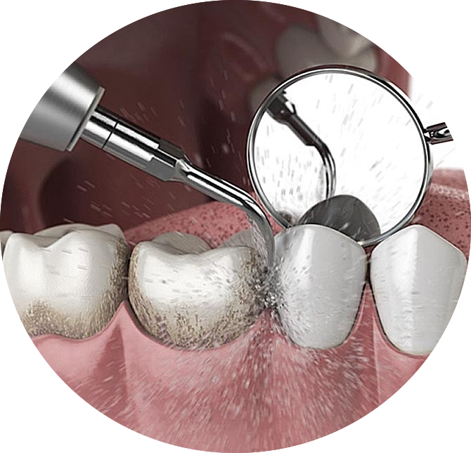 Чистка и отбеливание | ABC Clinic