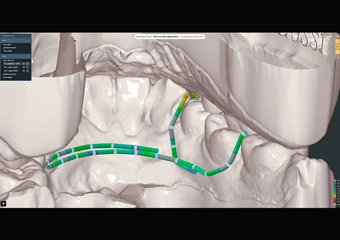 Проверка касаний верхней и нижней дуги в OrthoWireLab