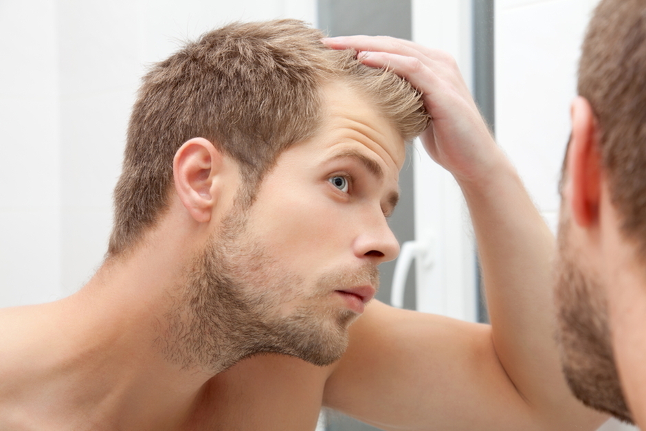 Причины выпадения волос у мужчин: стадии облысения и методы лечения - FUE  Clinic