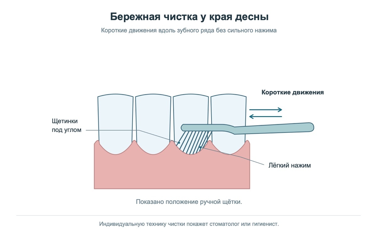 Бережная чистка зубов на учебной модели
