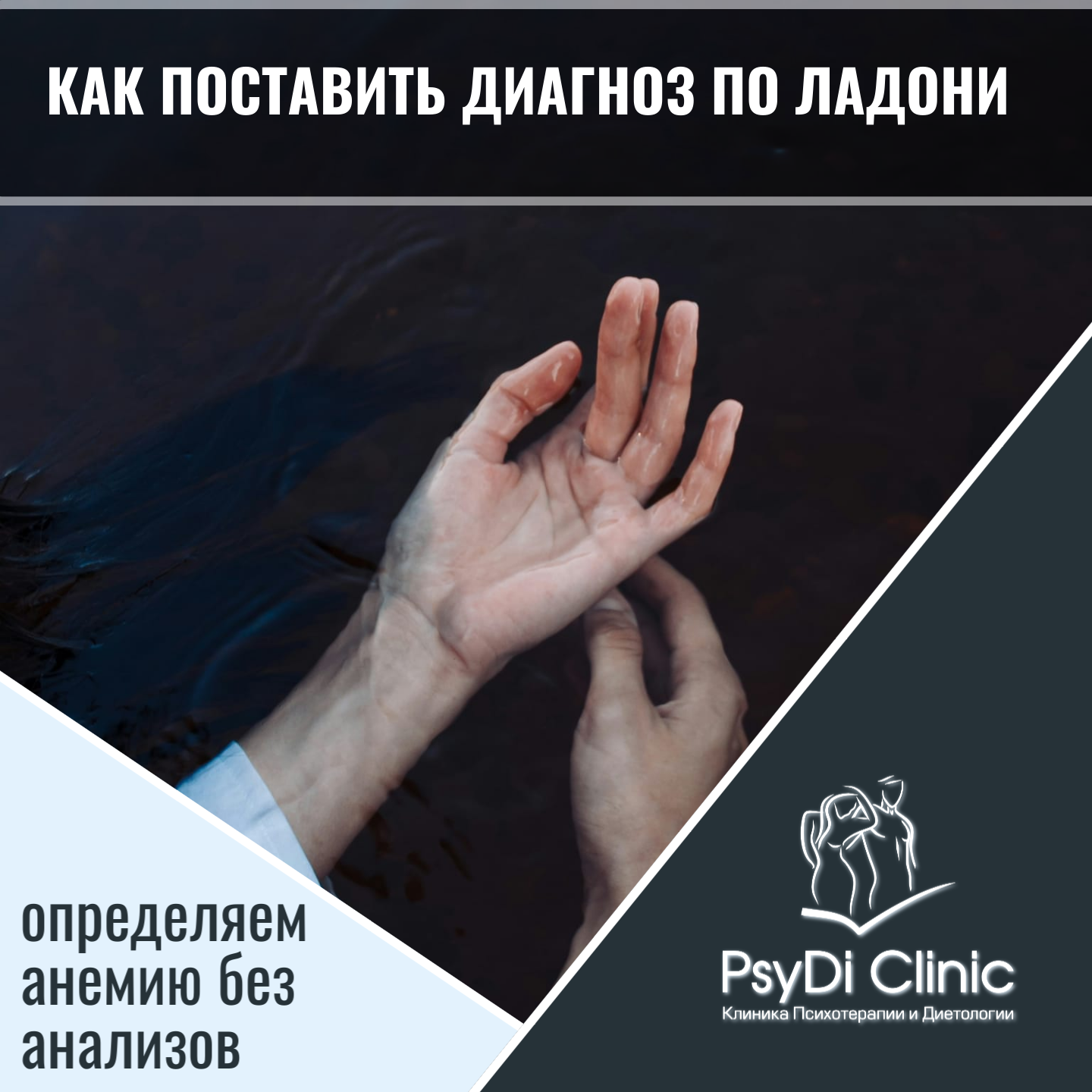 Как поставить диагноз по ладони: определяем анемию без анализов ��