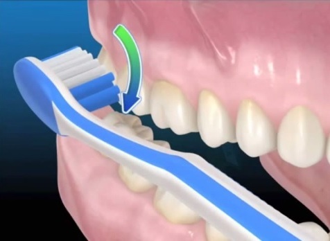 Как правильно чистить зубы электрической щеткой