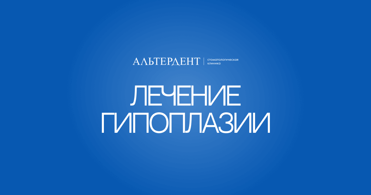 Лечение гипоплазии — Альтердент
