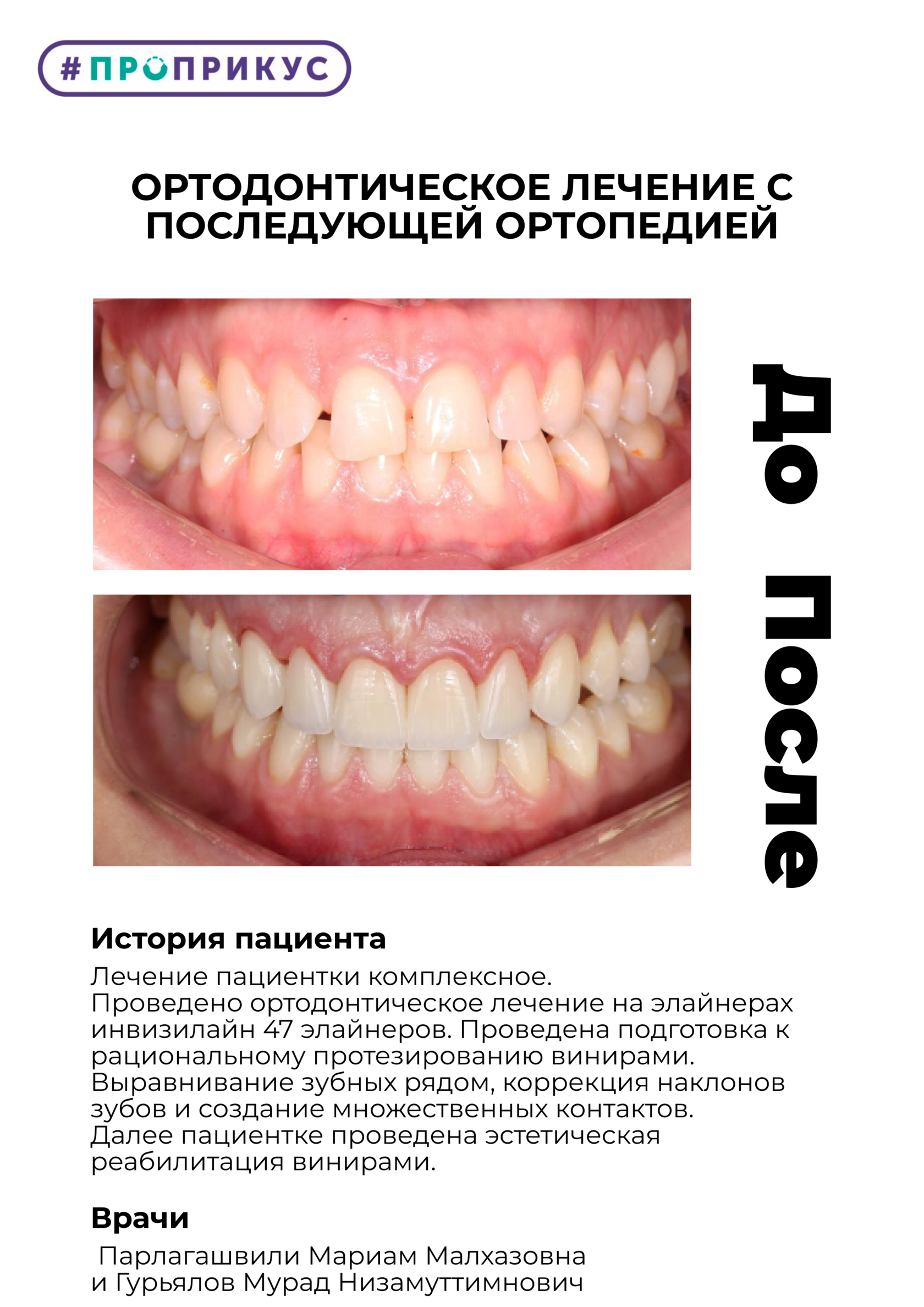 Скачайте гайд «Как понять, что у вас неправильный прикус?»