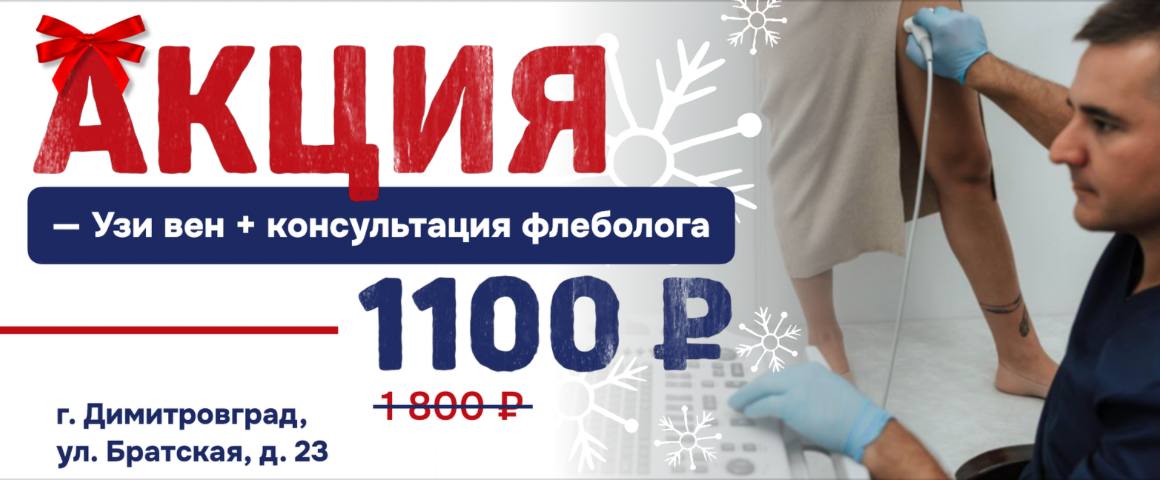Лечение варикоза - Венздрав клиника