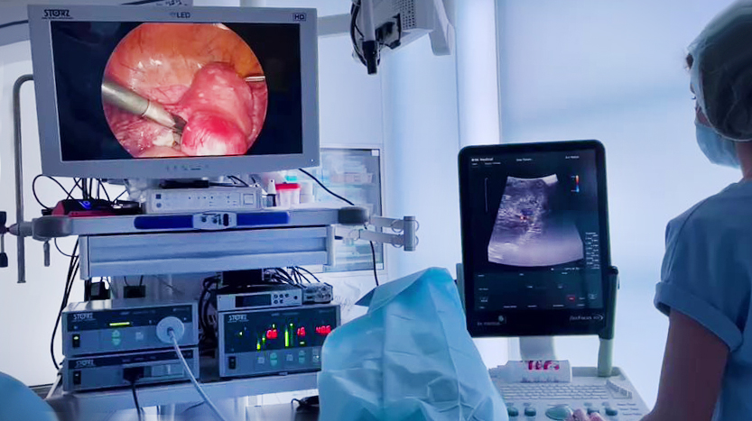 Эндометриоз. Ультразвуковая диагностика