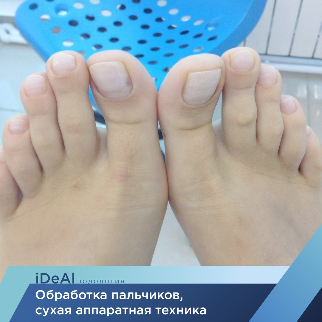 Педикюр в Курске