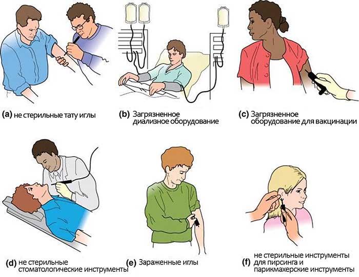 Можно ли заразиться ВИЧ и гепатитом, уколовшись об использованный шприц?