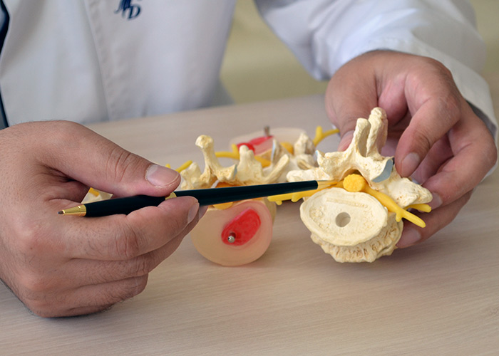 Лечение спондилолистеза позвоночника