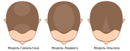 Модели Гамильтона, Людвига и Ольсена