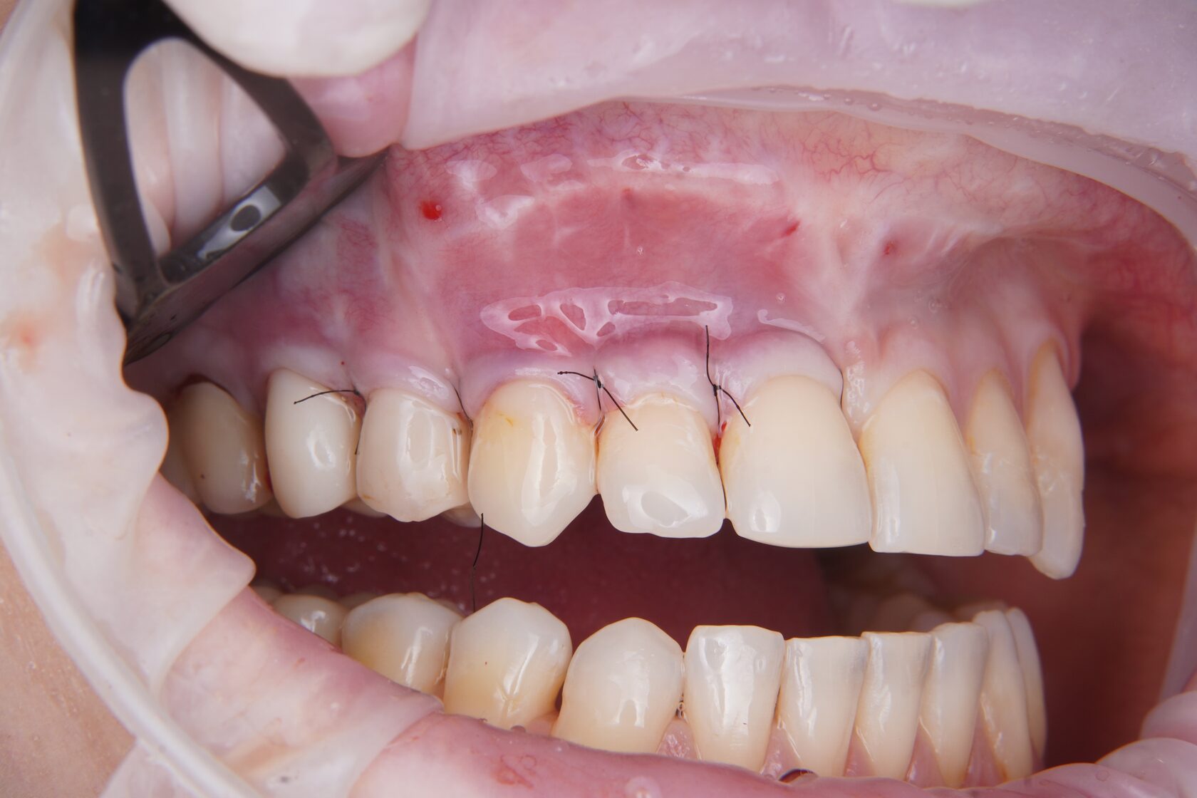 Хирургия — Dental Studio