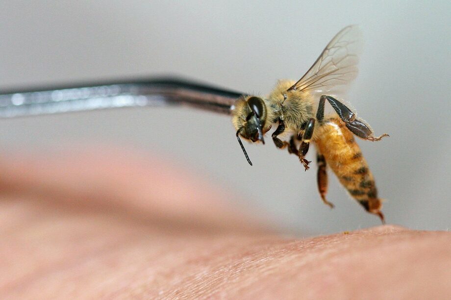 Эффективно ли лечение пчелиным ядом?