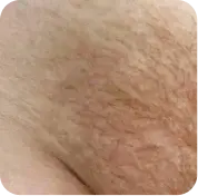До