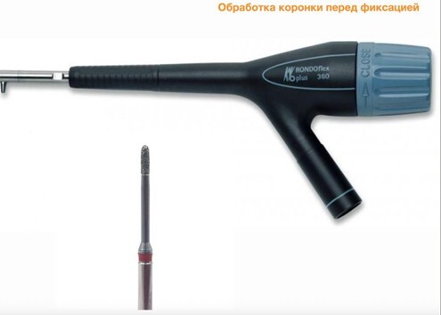 Обработка коронки перед фиксацией