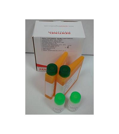 Альфа-1 Антитрипсин (Alpha-1 Anti-trypsine, Alpha1-antitrypsin, A1AT ...