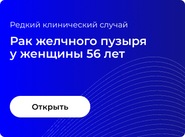 РАК ЖЕЛЧНОГО ПУЗЫРЯ У ЖЕНЩИНЫ 56 ЛЕТ