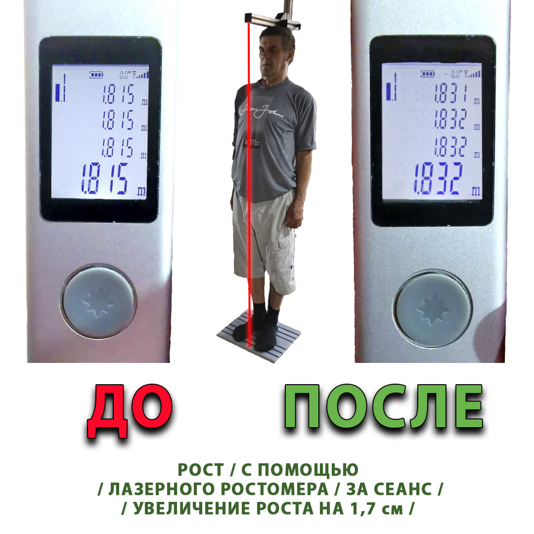 Фото контроля тракции позвоночника с помощью лазерного ростомера. До занятий и после занятий.