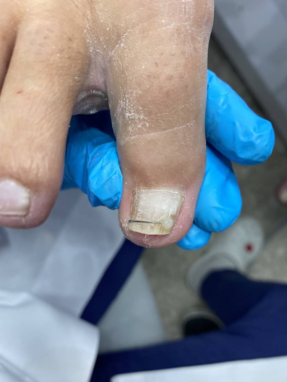 Крючок+клаящая