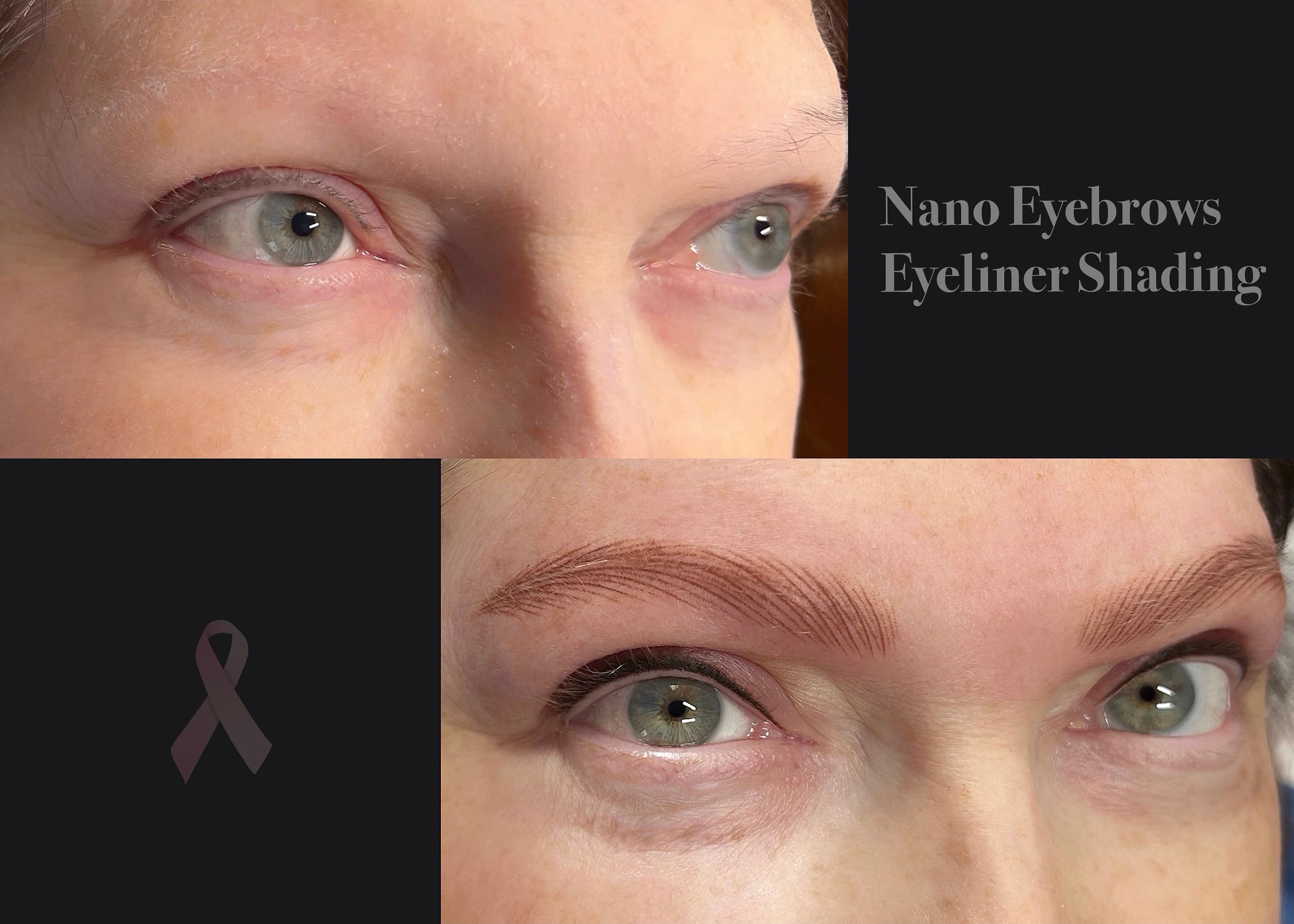 Permanent makeup for cancer survivors – eyebrow and eyeliner healing result