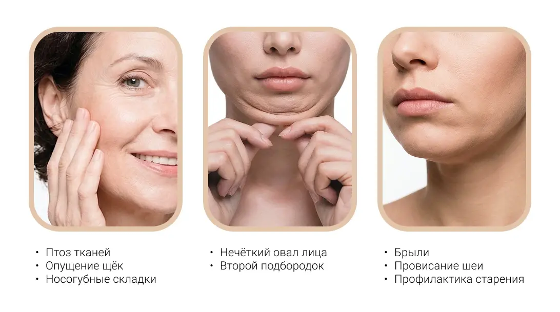 Показания для смас лифтинга Ультраформер 4 