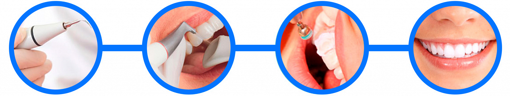 Этапы гигиены полости рта. Этапы профессиональной гигиены полости рта. Профессиональная чистка зубов этапы проведения. Проф гигиена ротовой полости этапы. Чистка зубов ультразвуком этапы.
