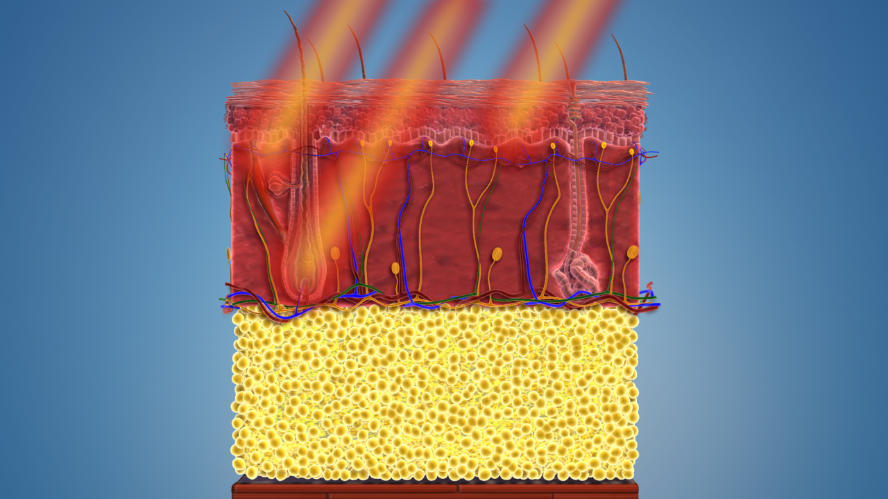Верить ли отзывам о лазере для эпиляции
