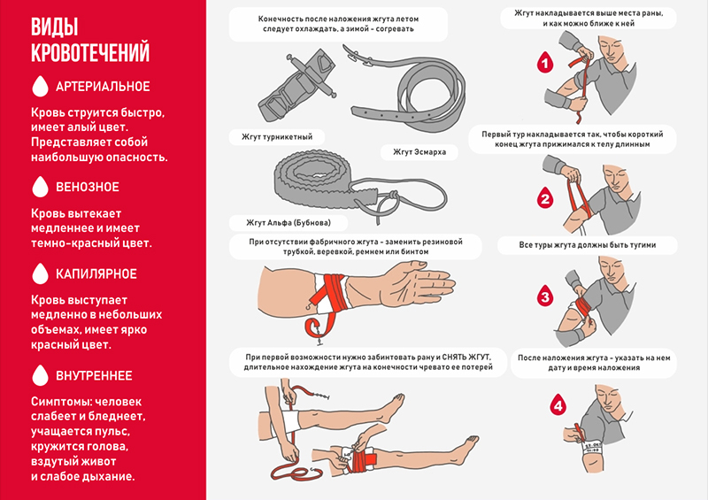 Кровотечения