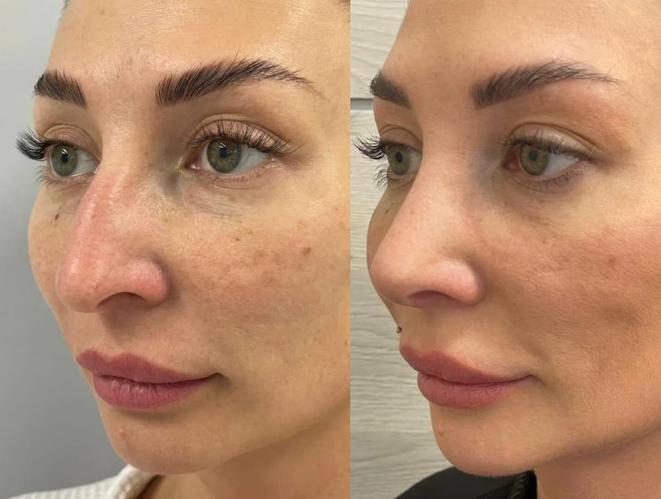 Хирург ринопластика москва