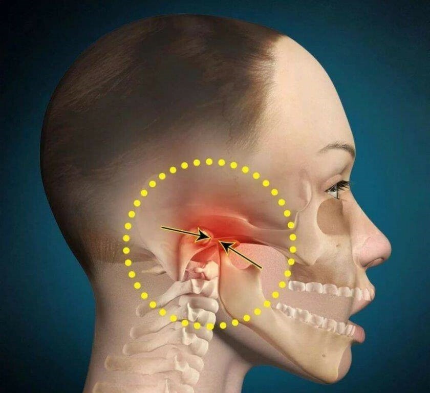 Щелкает сустав челюсти при открывании рта - причины, лечение, цены