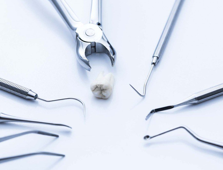 Атрофия костной ткани после удаления зуба: причины
