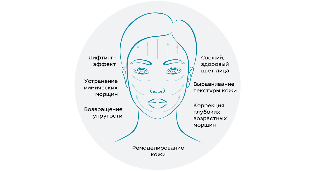 Лифтинг эффект. Схема лица для косметолога. Омолаживание лица. Схема для РФ лифтинга аппарат.
