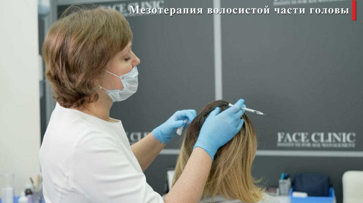 Мезотерапия для волос от выпадения в Москве от 17500 руб. Face Clinic