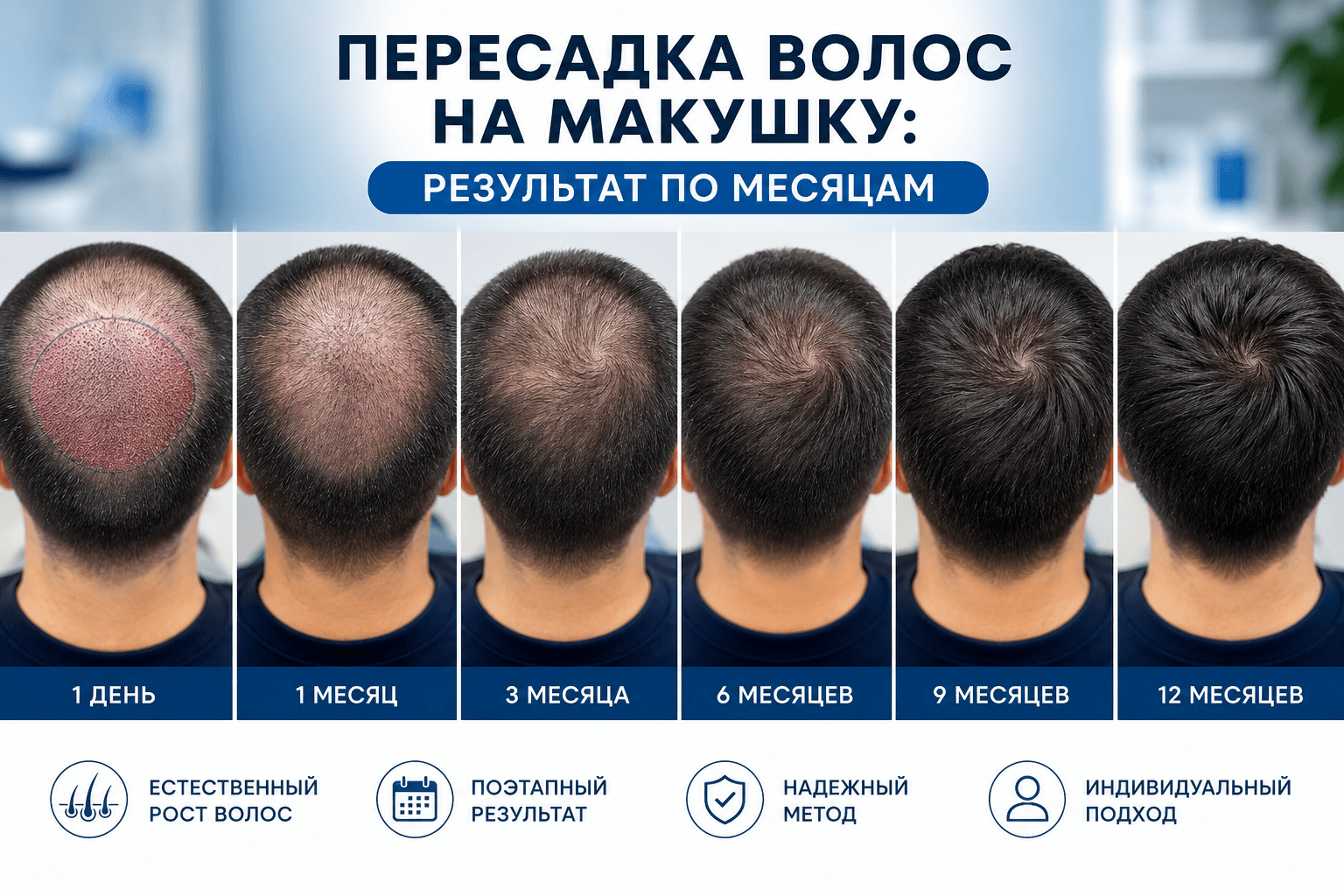 пересадка на макушку результаты по месяцам