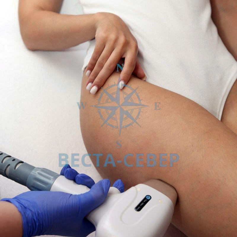 Гладкая кожа безопасно и навсегда: все о лазерной эпиляции