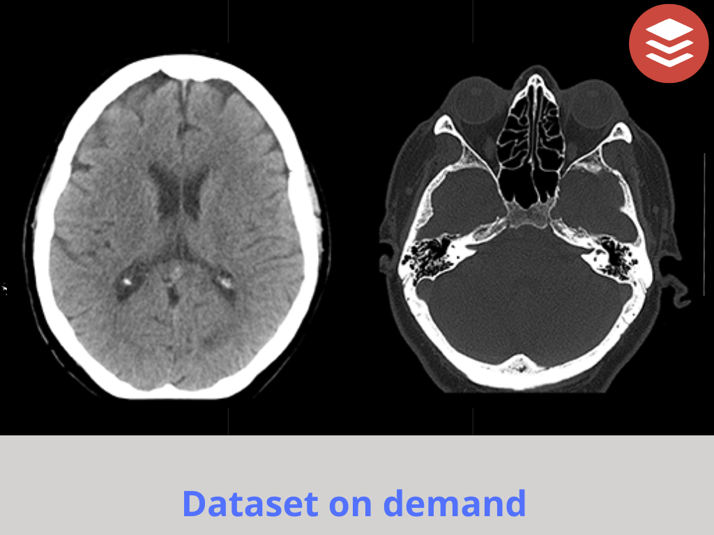 Кт головы стоя. Кт томограмма головного мозга. РКТ головного мозга. Компьютерная томография кт головного мозга.