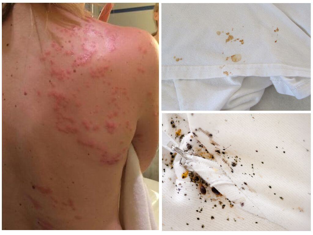 Что из себя представляет обработка холодным туманом?