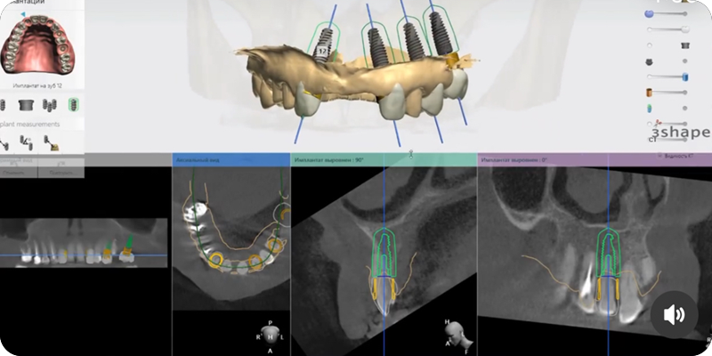 Виртуальное планирование