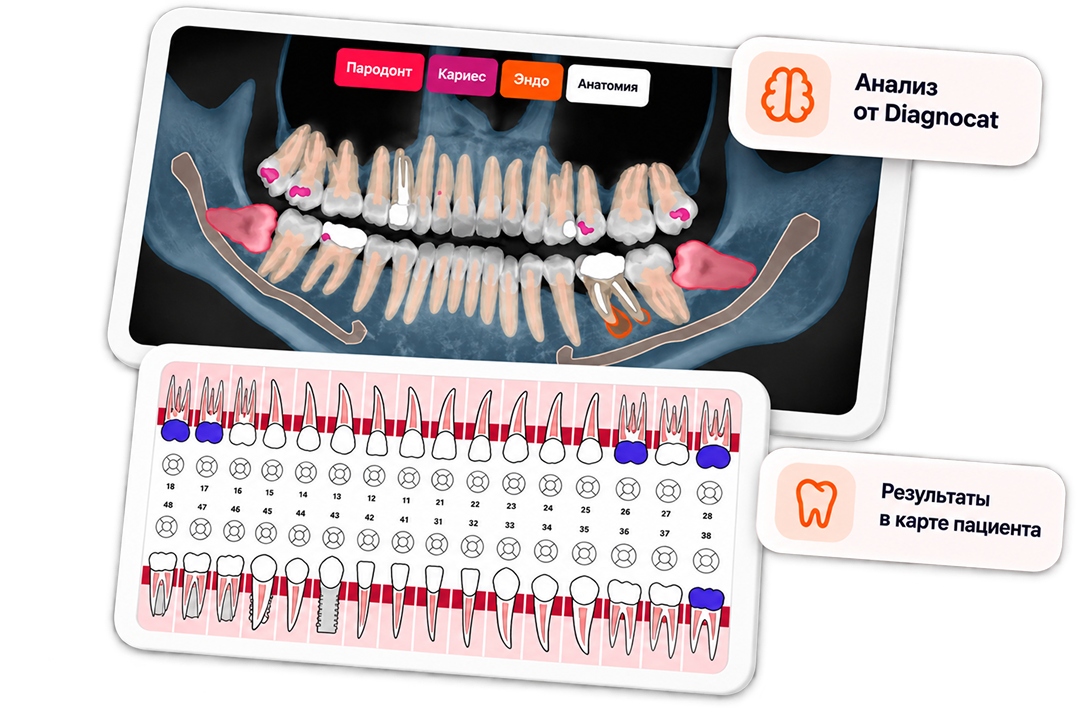 Анализ снимка в Diagnocat и результаты в карте пациента SQNS