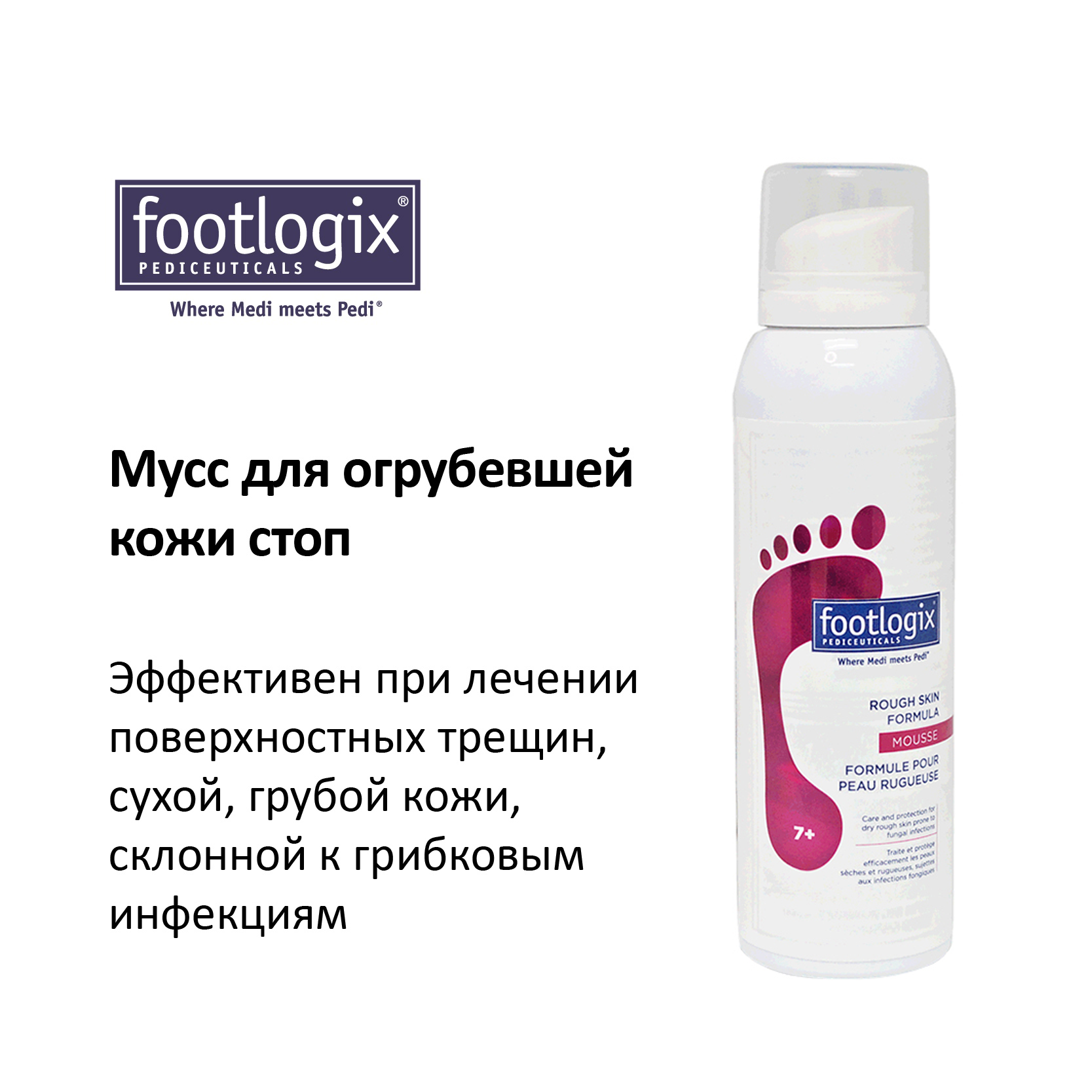 крем для грибковых заболеваний. крем для кожи. крем супер пятки. пенный размягчитель для ног. средство для кожи стоп.