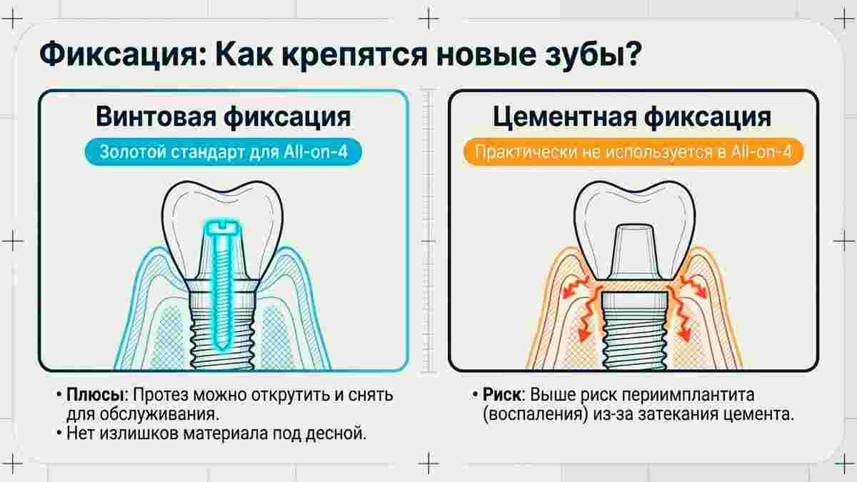 Как крепятся новые зубы?