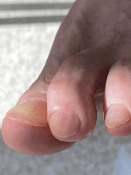 аппарат для педикюра, ногти педикюр