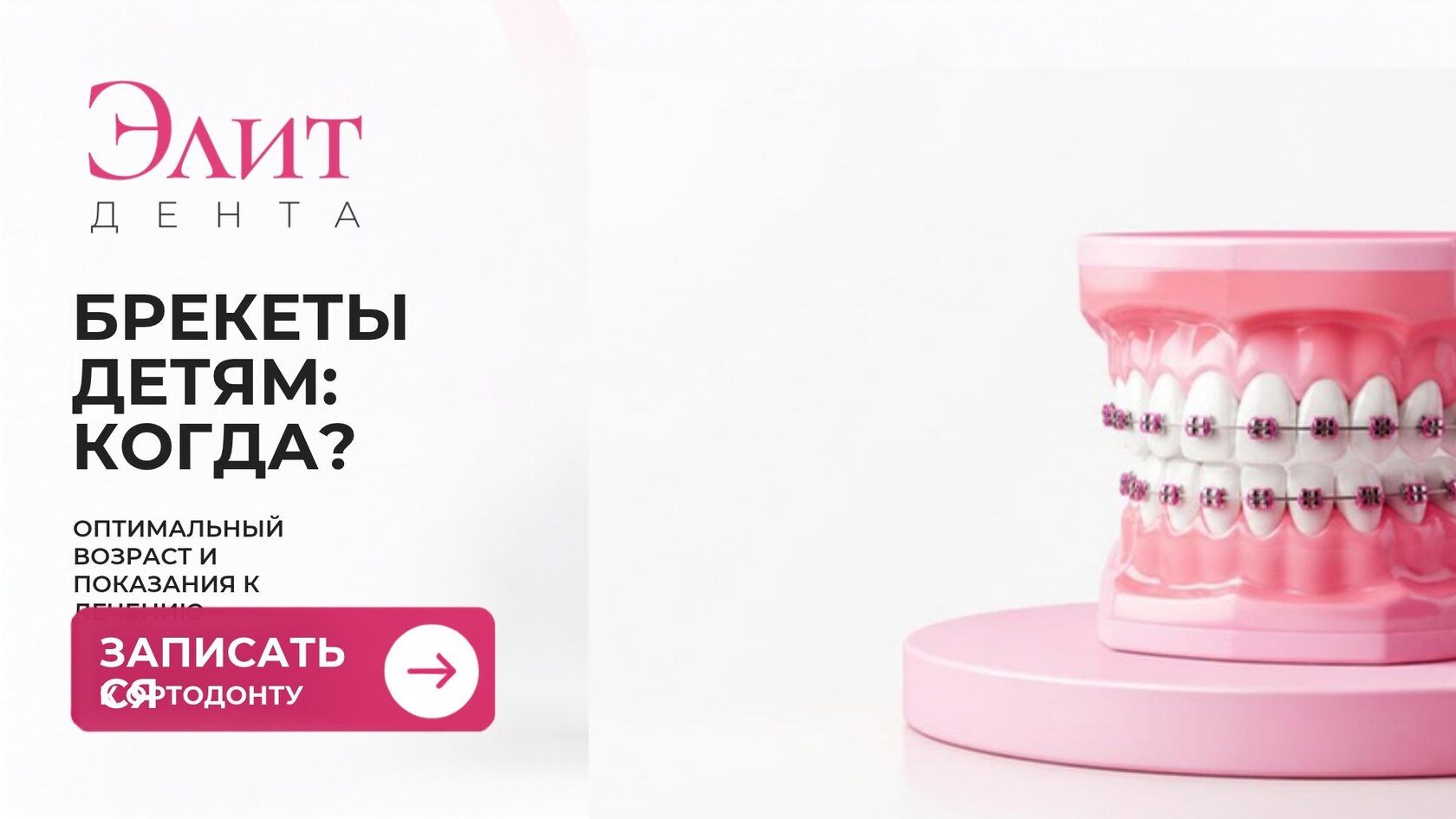 Брекеты детям: когда и зачем ставить