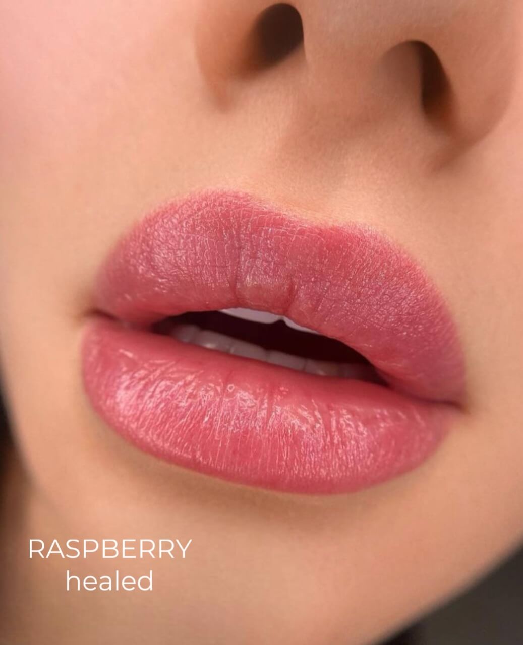 Raspberry