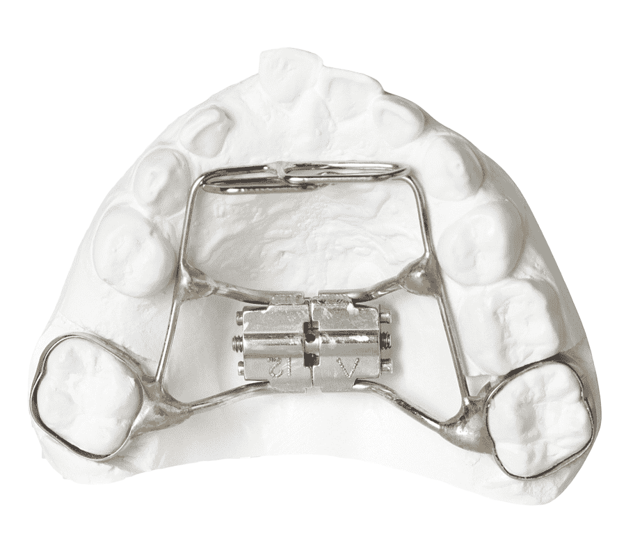 Кольцо петля ортодонтия для ребенка