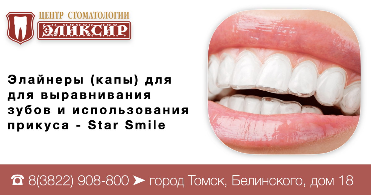 Капы для выравнивания зубов Томск Каменская